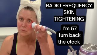 SKIN TIGHTENING with Radio Frequency Turn back the clock age backwards [upl. by Yllil]