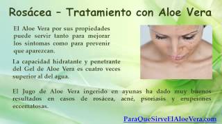 Rosacea  Aloe Vera Para la Cara [upl. by Ellehcir403]