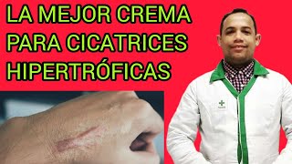 LA MEJOR CREMA PARA CICATRICES HIPERTRÓFICAS [upl. by Llezo22]