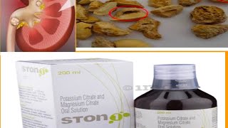 Ston 1 Potassium Citrate Magnesium Citrate Kidney ki pathari ki dawa Kidney Stone [upl. by Ad]