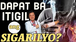 Dapat Ba Itigil ang Sigarilyo  By Doc Willie Ong 1084 [upl. by Sitoiganap240]