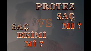 PROTEZ SAÇ MI SAÇ EKİMİ Mİ [upl. by Airednaxela543]