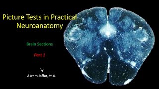 Picture Test in Neuroanatomy Brain Sections 1 [upl. by Isnan912]