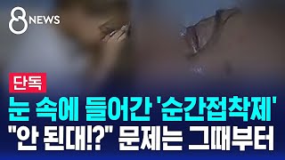 단독 눈 속에 들어간 순간접착제…quot안 된대quot 문제는 그때부터  SBS 8뉴스 [upl. by Richart]