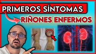 ESTOS son los 9 PRIMEROS SÍNTOMAS de unos RIÑONES ENFERMOS  Indican INSUFICIENCIA RENAL [upl. by Haidebej]