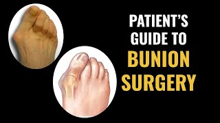 Patients Guide to Bunion Surgery [upl. by Eadwina]