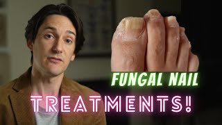 Fungal Nail Treatments [upl. by Kassia]