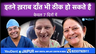 डेंटल इम्प्लांट्स से फिक्स दाँत कैसे लगाए जाते है best dentist for dental implant in india drrajesh [upl. by Ias]