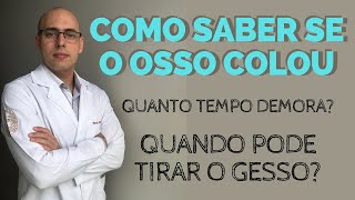 COMO SABER SE O OSSO COLOU Consolidação óssea [upl. by Harrat]