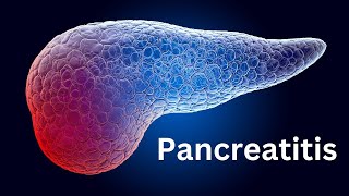 Pancreatitis Everything You Need To Know [upl. by Jeniffer]