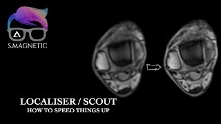 LOCALISER SCOUT HOW TO SPEED THINGS UP [upl. by Lecroy]