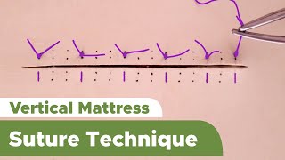 Suture Techniques and Training Series Interrupted Vertical Mattress Suture Technique [upl. by Aura821]