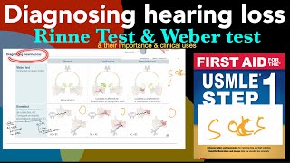 Diagnosing hearing loss  Rinne test amp Weber test amp their clinical uses amp importance in HindiUrdu [upl. by Artimed806]