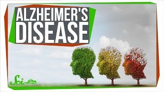 How Close Are We to Curing Alzheimers [upl. by Hnahk46]