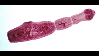 Echinococcus Multilocularis  The Small Fox Tapworm [upl. by Heilman]