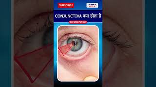 Conjunctiva क्या होता है conjuctivitis conjuctivitisintheeye conjuctivitistreatment thydochealth [upl. by Nodaj]