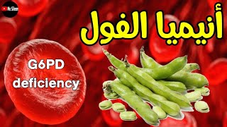 G6PD deficiency انيميا الفول favism 🫛🫘 [upl. by Tsan]