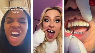 Tiktok Teeth Trends Gone WRONG [upl. by Arymat679]