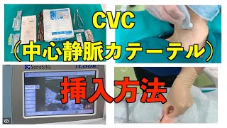 研修医必見❗CVC中心静脈カテーテルの挿入方法、手順 [upl. by Nylirehs]