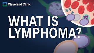 What Is Lymphoma [upl. by Astor]