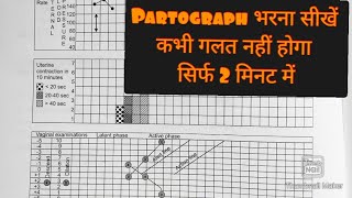 How to fill partograph with example Part3 Practical application of partograph progress of labor [upl. by Tuchman925]