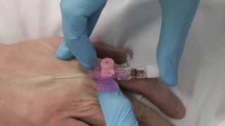 Cannulation How to insert a cannula One Minute Edition Medicine in a Nutshell IV Access [upl. by Cirdes]