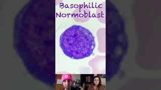 Basophilic Normoblast Morphological Characteristics [upl. by Eecats]