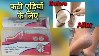 फटी एड़ियों के लिए Foot Mark cream uses in hindi  फुट मार्क मलहम का उपयोग [upl. by Sang]