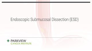 Endoscopic Submucosal Dissection ESD [upl. by Ateekram]