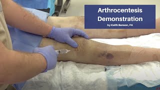 Arthrocentesis Demonstration  The CadaverBased EM Procedures SelfStudy Course [upl. by Eetnwahs]