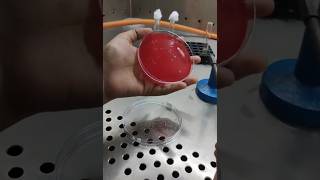 How To Streak For Blood Agar Plates Bacterial Streaking Technique [upl. by Fisher244]