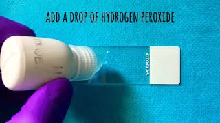 Catalase and Oxidase Test  clinical microbiology essentials [upl. by Gnuhp289]