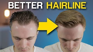 5 POWERFUL Receding Hairline Tricks To INSTANTLY Improve Your Look [upl. by Melnick123]