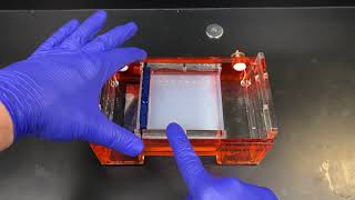 Agarose Gel Electrophoresis [upl. by Eniamrej188]