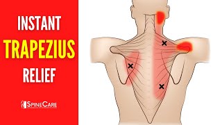 How to Relieve Trapezius Pain FOR GOOD [upl. by Beverle492]