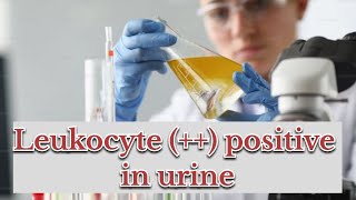 leukocytes positive in urine  symptoms causes  treatment [upl. by Neomah51]