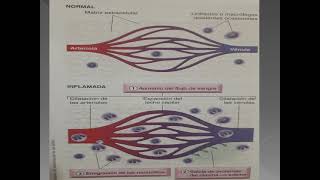 CLASE TEÓRICA 6  INFLAMACIÓN Y REPARACIÓN TISULAR PARTE 1 [upl. by Sllew]