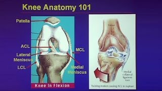 Common Traumatic Knee Injuries Oh My Aching Knee [upl. by Lamprey]