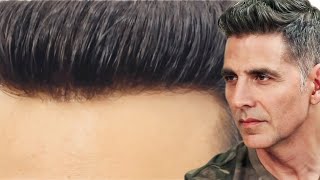 AkshayKumar Hair Patch service for men Delhi Natural lace Hair Wigs Non surgical hair replacement [upl. by Ocram]