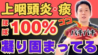 【自分でできる】上咽頭炎を自力で治したい方は必見！たった3秒の簡単ストレッチと改善方法 [upl. by Robenia]