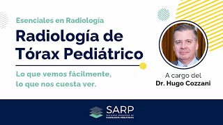 Clase sobre Radiología de Tórax Pediátrico  Lo que vemos fácilmente lo que nos cuesta ver [upl. by Sephira]