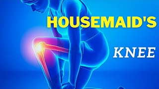 housemaidsknee What is Housemaids Knee [upl. by Pippo]