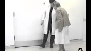 Parkinsonian shuffling gait [upl. by Mihcaoj252]