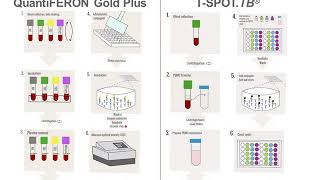 Interferon Gamma Release Assays IGRAs [upl. by Calabresi359]