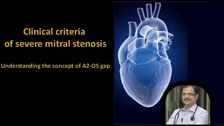 Clinical Criteria of Severe Mitral Stenosis Understanding A2 Opening Snap Gap amp Murmur Length [upl. by Wiatt]