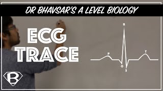 A level biology ECG trace [upl. by Eahsel]