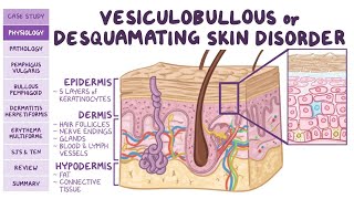 Normal Structure and Function of Skin  Pathology and Microbiology Lecture 1 [upl. by Hock]