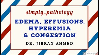 GENERAL PATHOLOGY II EDEMA EFFUSIONS HYPEREMIA CONGESTION II CHAP 4 II ROBBINS 10TH EDITION [upl. by Benedict993]