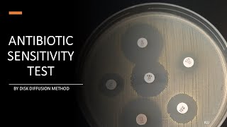 Antibiotic Sensitivity Test by Disc diffusion method Kirby Bauer method amp Stokes method [upl. by Charil54]