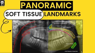 Panoramic Radiography landmarkOrthopantomogramOPG Soft tissue LandmarkAirwayDental Radiology [upl. by Alemak]